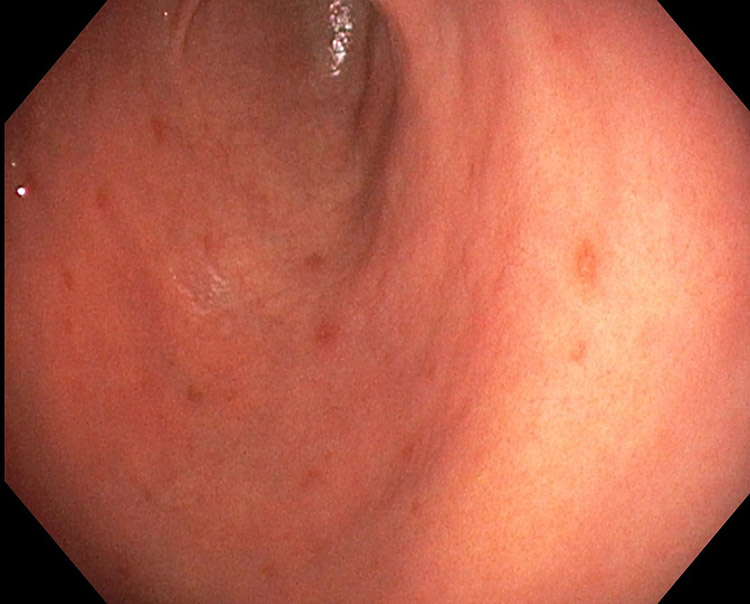 医師に連絡する時期